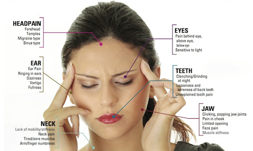 Tmj Headache Location Chart